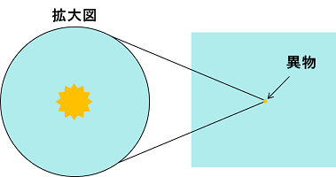 異物の拡大模式図